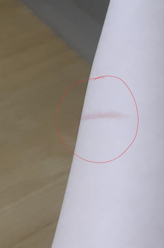 첫번째껀 흉터도 두번째꺼는 최근에 대여서 아직 빨감. 둘다 요리하다가 냄비나 그런거 사이드에 붙어서 대였는데 물로만 헹구고 다른 조치 안취해서