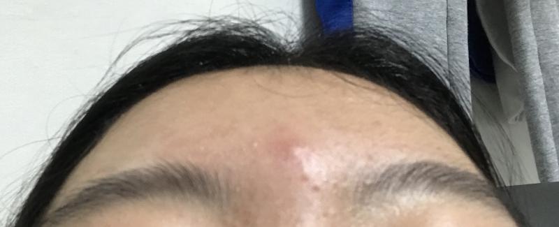 보여? 보이냐고 저 이마 딱 한가운데에 난 저 빨간색 보이냐고𝙎𝙄𝘽𝘼𝙇ㅜㅜㅠㅠㅠㅠㅠㅠㅠㅠㅠㅠㅠㅠㅠㅠㅠㅠㅠ