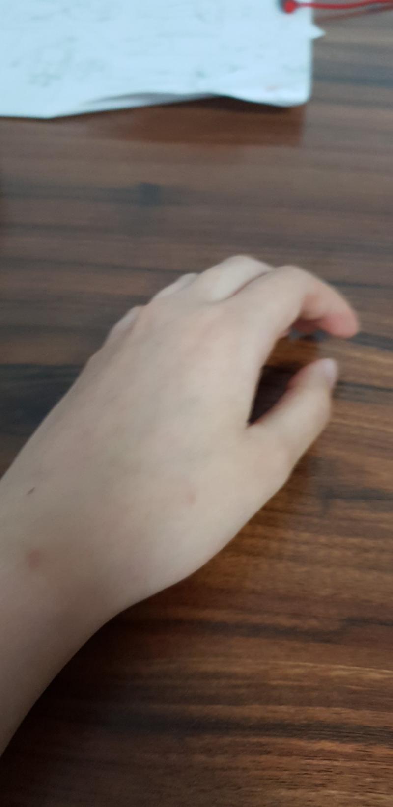 둘다 힘뺀상태인데 왼손이 정상