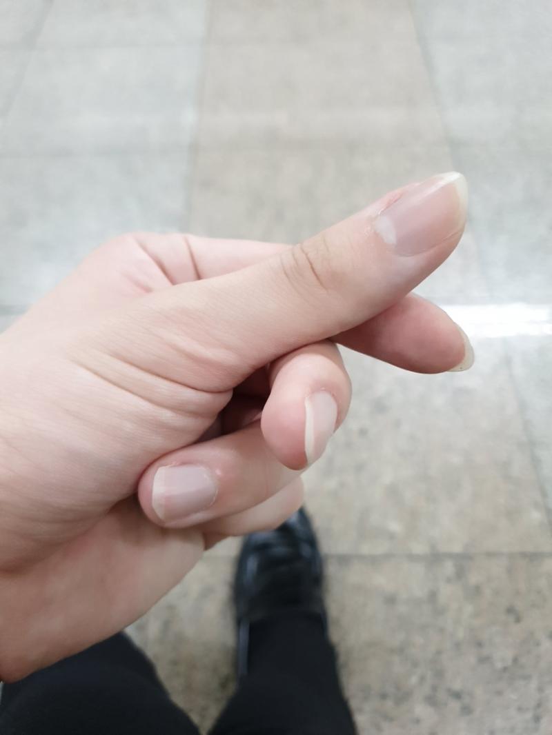 널 사랑해. 엇박으로 자른 손톱은 함정