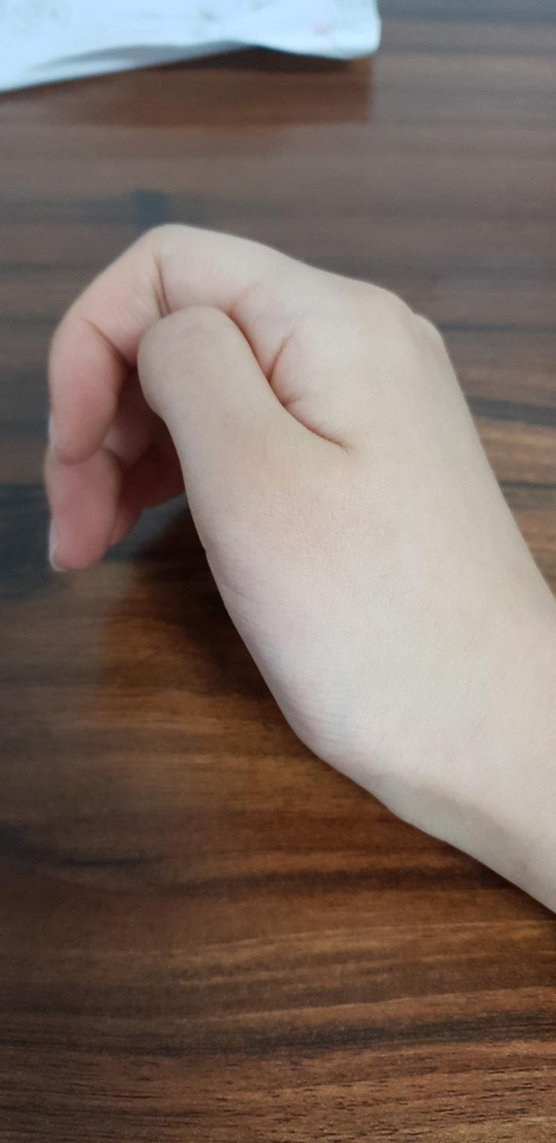 둘다 힘뺀상태인데 왼손이 정상