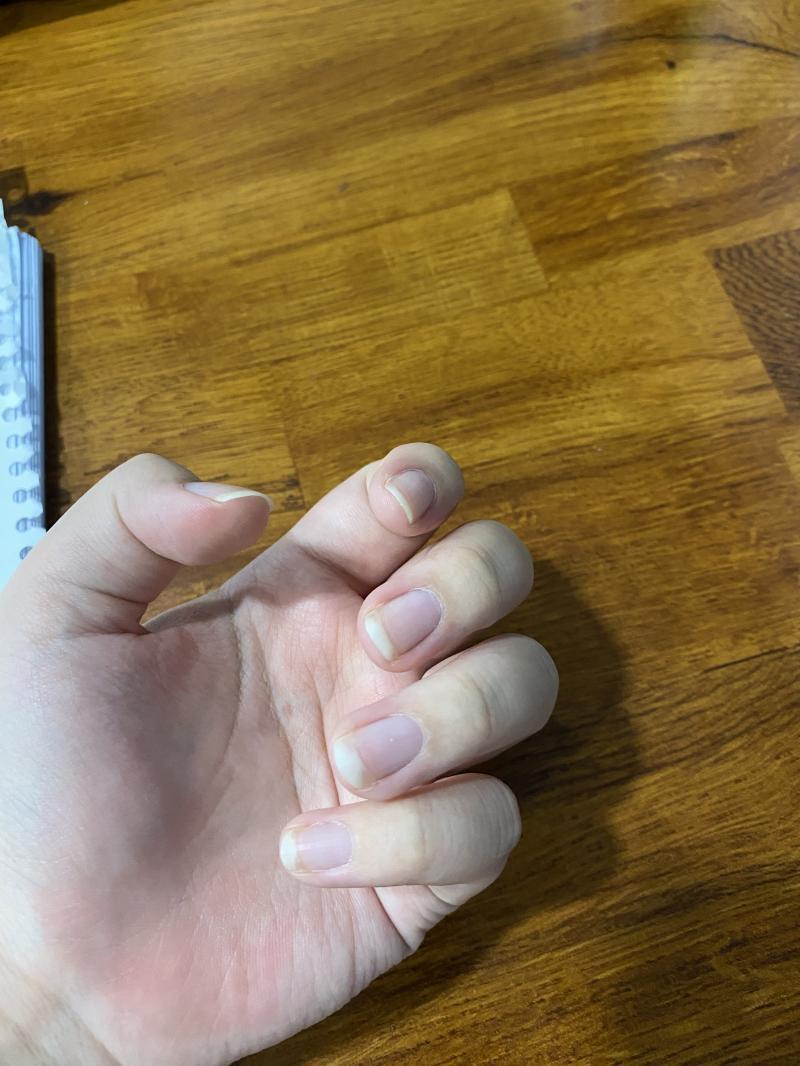 안 이쁘고 퉁퉁한 내 손 투척 다들 손이 예쁘네 개부라움