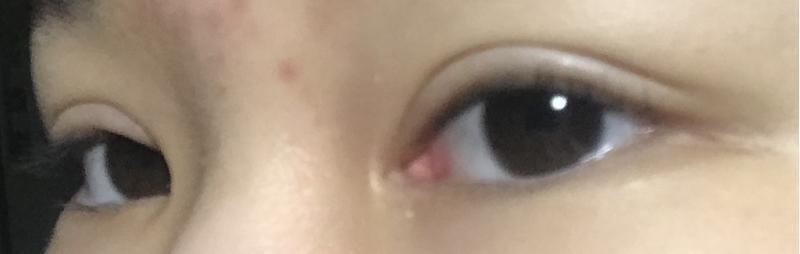 차례로 그냥 자연스럽게 뜰때, 좀 힘줘서 뜰때, 약간 측면에서 찍은 사진이야.