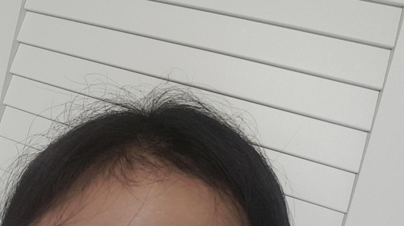현 내 머리 상황...