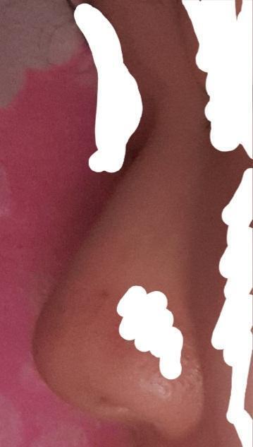 내 코가 이렇게 좆같은줄 처음알았어! 엄마가 왜 성형하랬는지 이해가 가는중