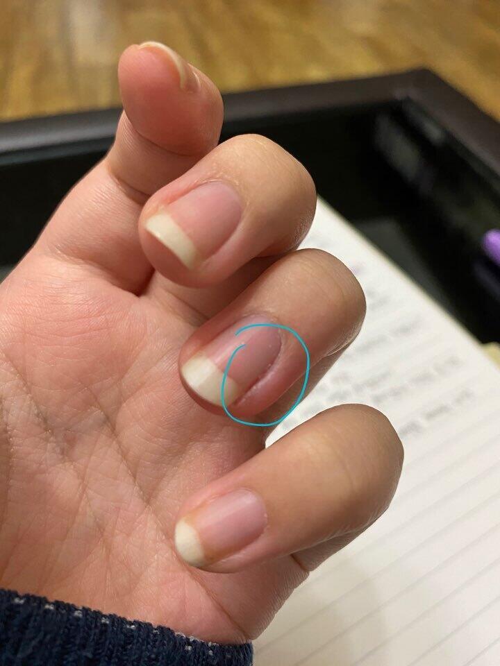 사진이용