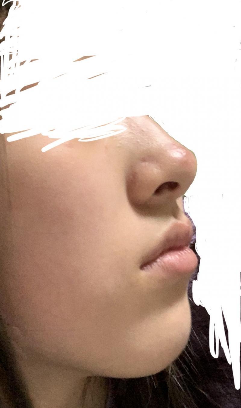 ㅎㅎ 오때 얘들아