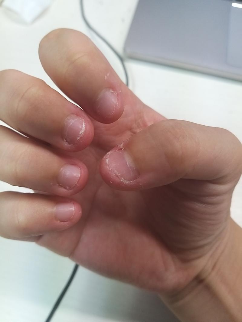 진짜 어디가서 손 보여주기 쪽팔려..