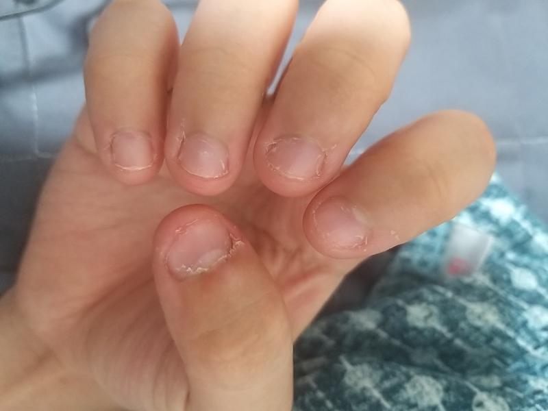 헉 오늘 까먹고 안올뻔.. 아까 영화보면서 집중하다가 손톱 살짝 뜯어버렸어.. 앗 하고 바로 땠는데 묘하게 티나는거 같고 그런다..