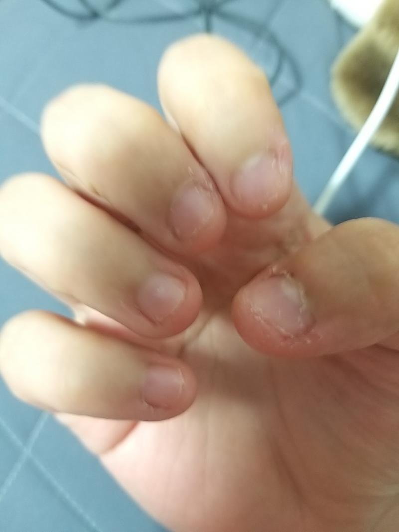 아악 주위살 뜯어버렸어.. 왼손도.. 손톱은 최대한 안뜯으려 노력중인데 그게 잘 안된다.. 역시 세 살 버릇 여든간다고...