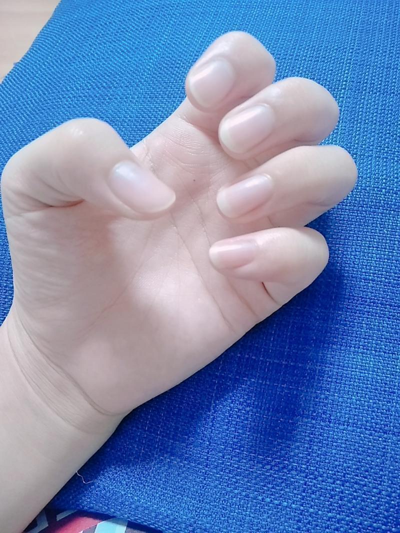 손톱 나도 맨날 물어뜯고 빨다가 손톱 빠졌었는데 딱 너랑 같았거든 뜯는거 고치고 손톱옆부분 나와있는곳만 조금씩 일자로 갈면서 길렀는데 이케됌