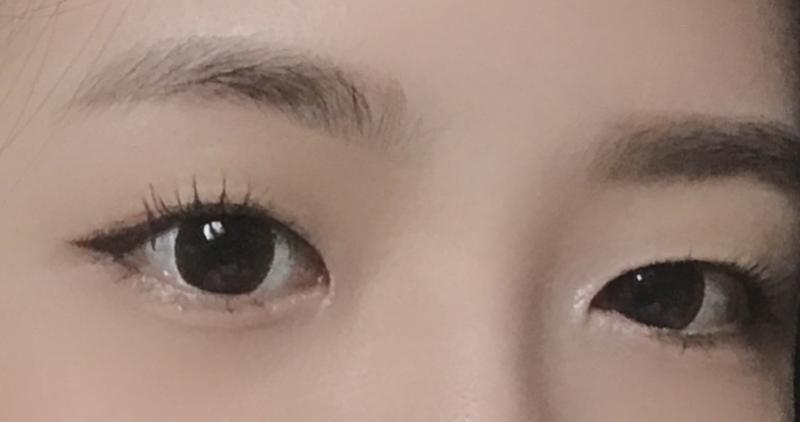 여기..왼쪽이 오른쪽 눈보다 훨씬 커..
