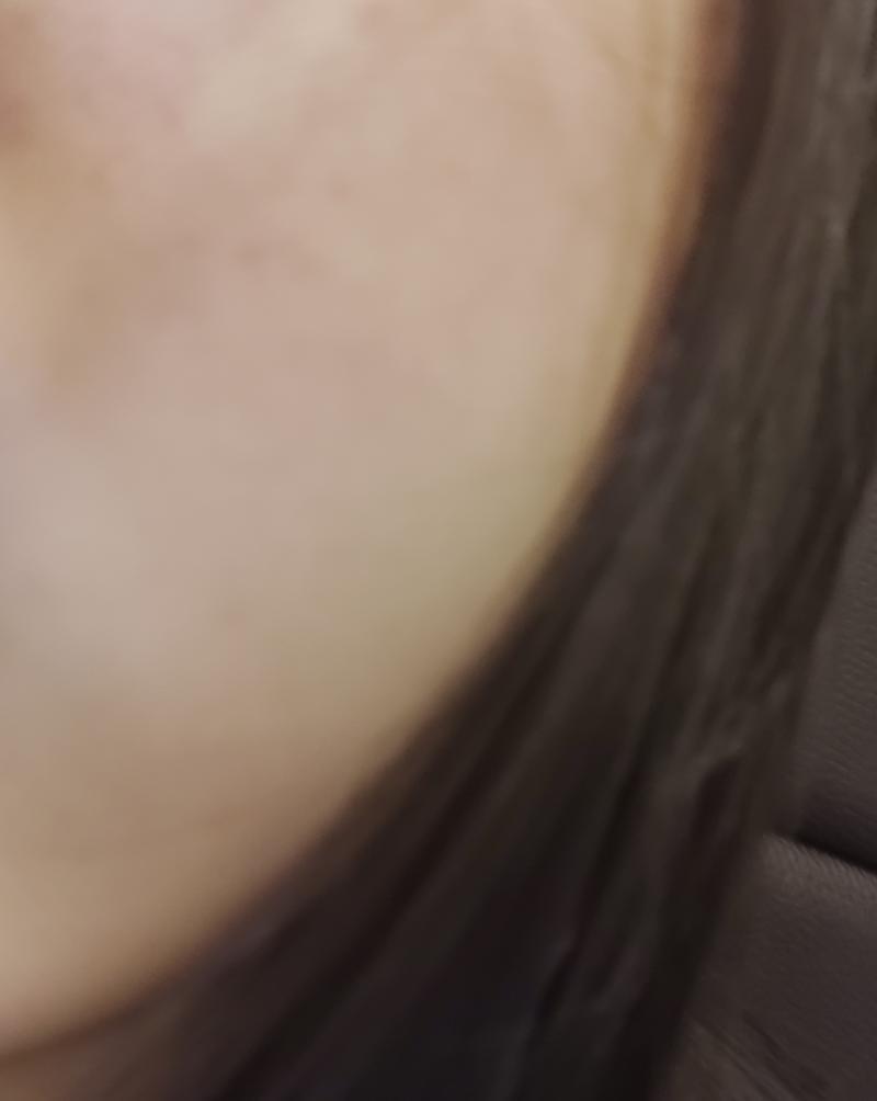 나 3번 레스준데 진짜 ㄹㅇㄹ 피부과 가ㅠㅠㅠ크림이나 앰플들 솔직히 써보기 전까진 모르잖아 맞는거 찾는다고 돈 날리고 이럴바엔 진짜 피부과 가는