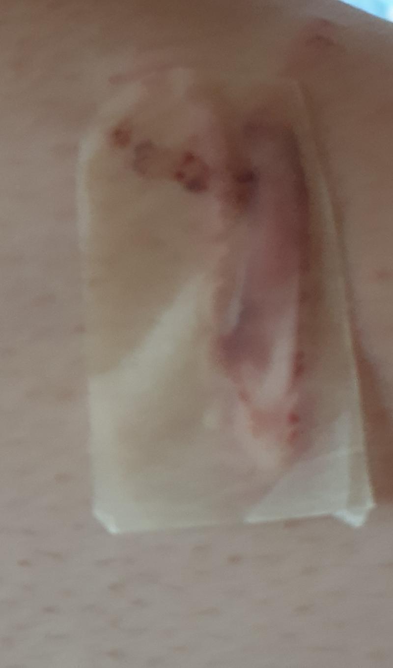 또 흉질거같아
