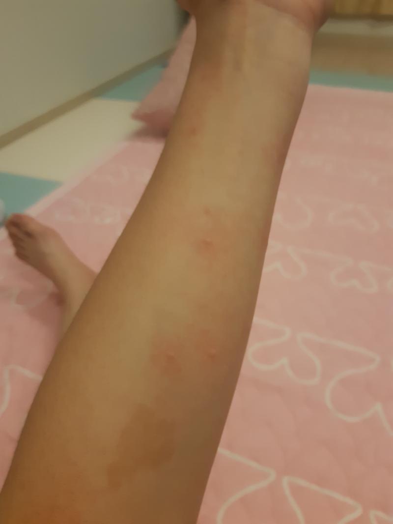 내 팔 ㅅㅂ....