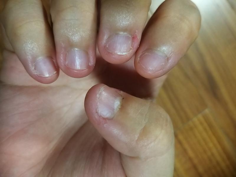 >>38 내가 와따 지인하고 게임하고 누워서 폰보면서 아무생각없이 손톱 뜯다가 놀라서 들어왔어.. 꾸준하기만 하지 절제력이 없는거같아.. 진짜