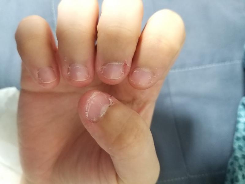 오늘도 왓다리 발톱 만지다가 엄지손톱이 나가버렸다리 발은 비누로 씻었으니 괜찮다리