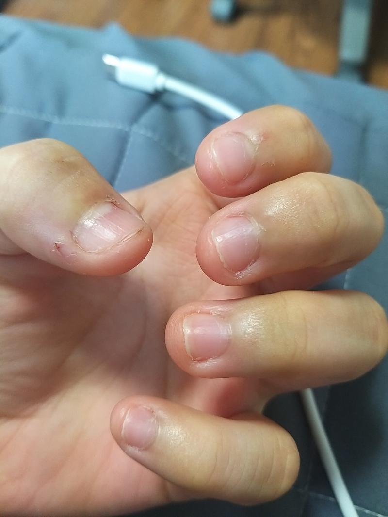 오른손 손톱이 좀 더디게 자라는거 같아 안그래보이지만 책상에 손톱으로 딱 소리 낼 수 있게됐다!