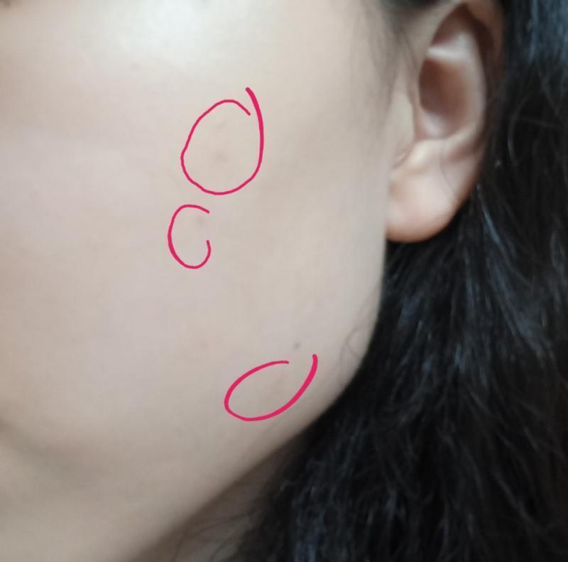 나 피부 되게 깨끗한편인데 잡티 몇개만나도 가라앉을때까지 화장안해 저기 사진 빨강 동그라미친거 보이징 잡티 가라앉는중이여 마스크써서 자극이 더
