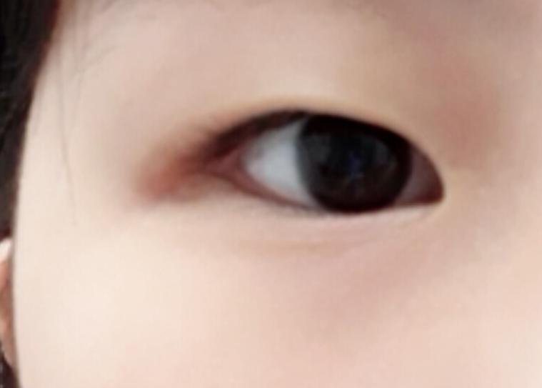 내 눈 사진 올릴게 엄청 용기낸 거니까 뭐라고 하진 말아줘ㅠㅠ
