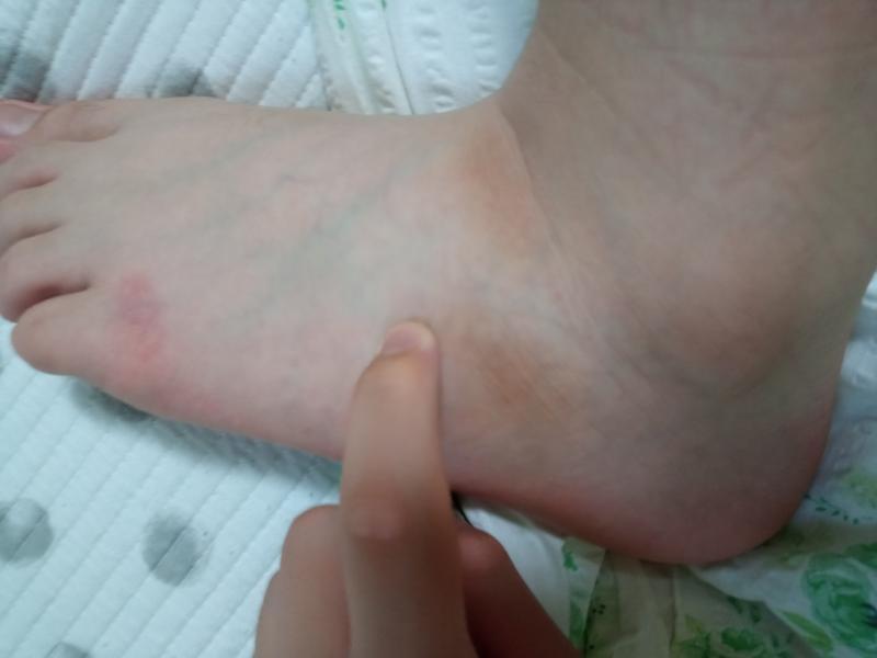 손가락끝이 닿은 쪽 주변이 아파. 근육에 문제가 생겼나...