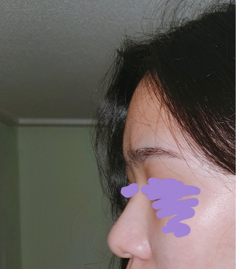 뿅