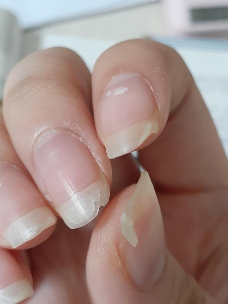ㅠ