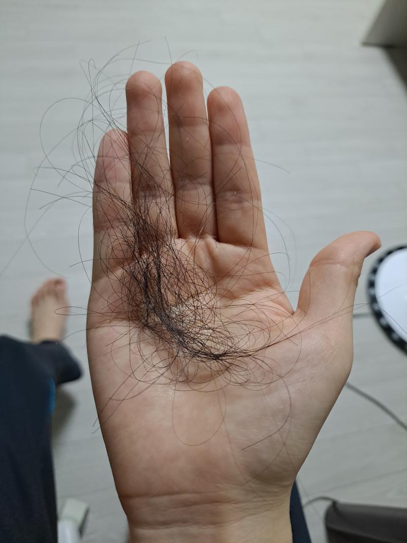머리카락이 이만큼이나 빠졌어 실제로 뜯긴건 이것보다 더 많아