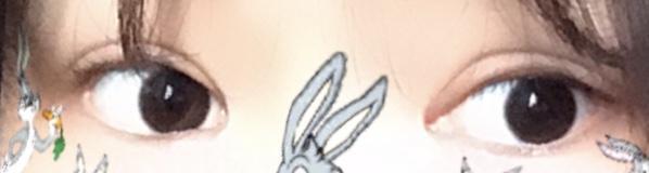ㅅㅂ레더야 내눈같음ㅋㅋ 붓기가 3개월 이후로 안빠지고있음 재수술 각 잡는 중