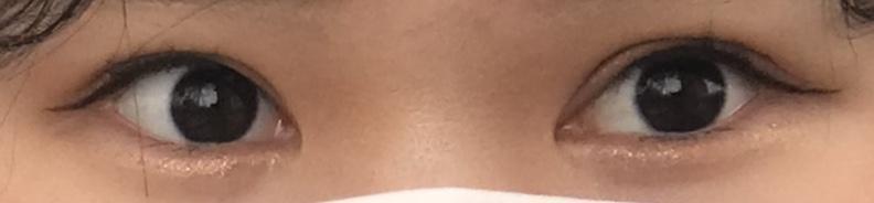 대충 어떤 눈인지 감이 오니,,,