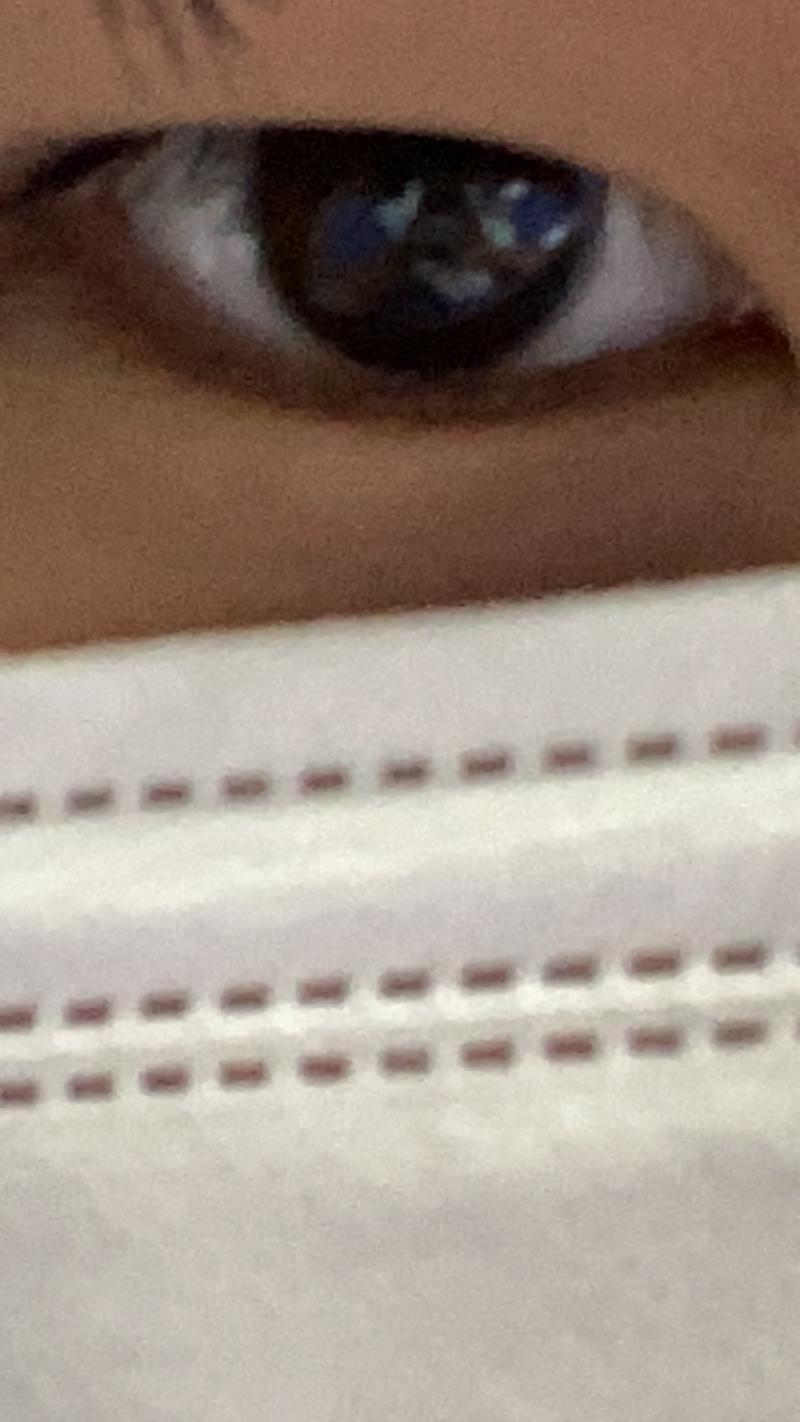 이건 안 한 눈