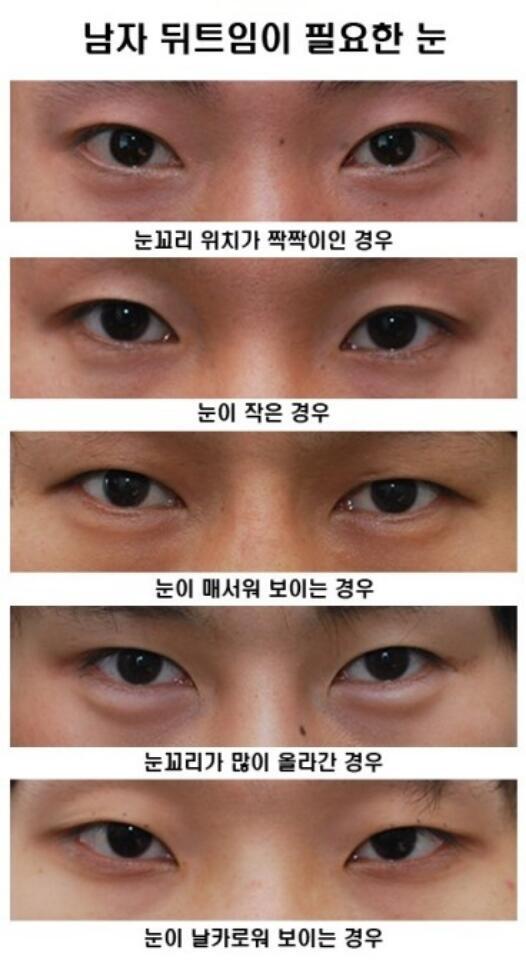 나 뒤틤은 아닌 듯 해당사항이 없어...