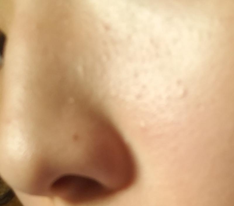 이건데 진짜 안없어져서 스트레스받아ㅠㅠㅠ