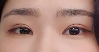 뿅