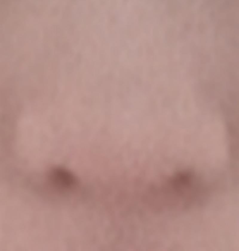 정말이야? 나!!나!!! 얼굴 짧고 갸름한데 살짝 사각턱(오마이걸 유아?같은 얼굴형) 눈 거리 조금 멀어ㅠㅠ(1: 1.2 :1)눈 크고 쌍꺼풀은