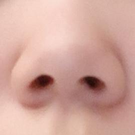 이렇게 정면에서보면 콧대 하나도없고 돼지코마냥 저거만 볼록 튀어나옴..