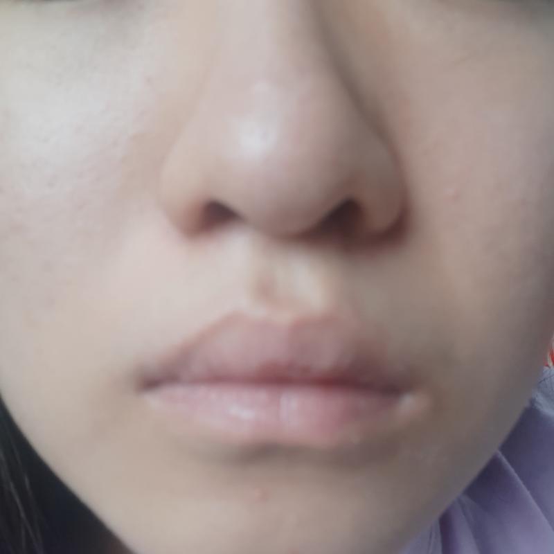 ㅠ...