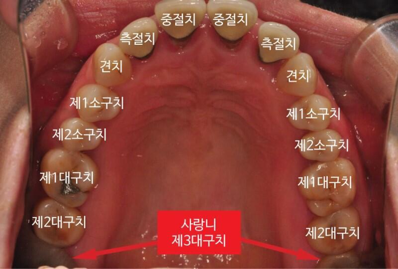>>20 난 아닌뎅..인터넷에서 퍼온 사진이야 보고 확인해 봐..