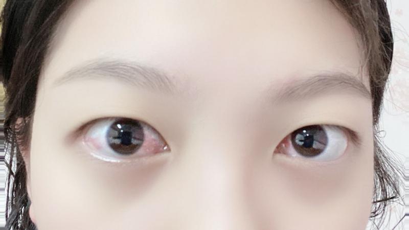 사진주의 충혈됨 아니 방금 찍엇는데 충혈뭐냐곸ㅋㅋㅋ 이게 고3인가 십... 나 무쌍에 눈크다는 소리 많이 들엉
