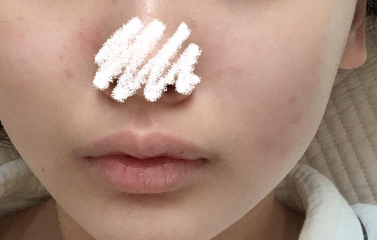 그리고 이게 오늘 아침 ㅠㅜㅠㅠ 많이 나빠졌자
