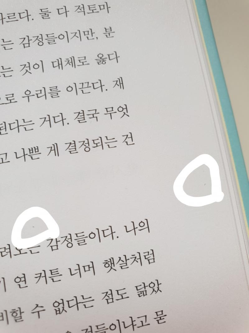 뭐야 오류인가 사진 올렸었는데 없어졌네 아무튼 >>5처럼 진짜 엄청 하얗고 작은 거,, 레알 새끼 발톱 50분의 1만큼 작은거였슴 >>3환기는