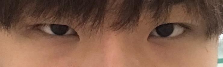 글쓴인데 사진 이렇게 올리는거 맞나 아무튼 내가 짝눈이 그렇게 심해?
