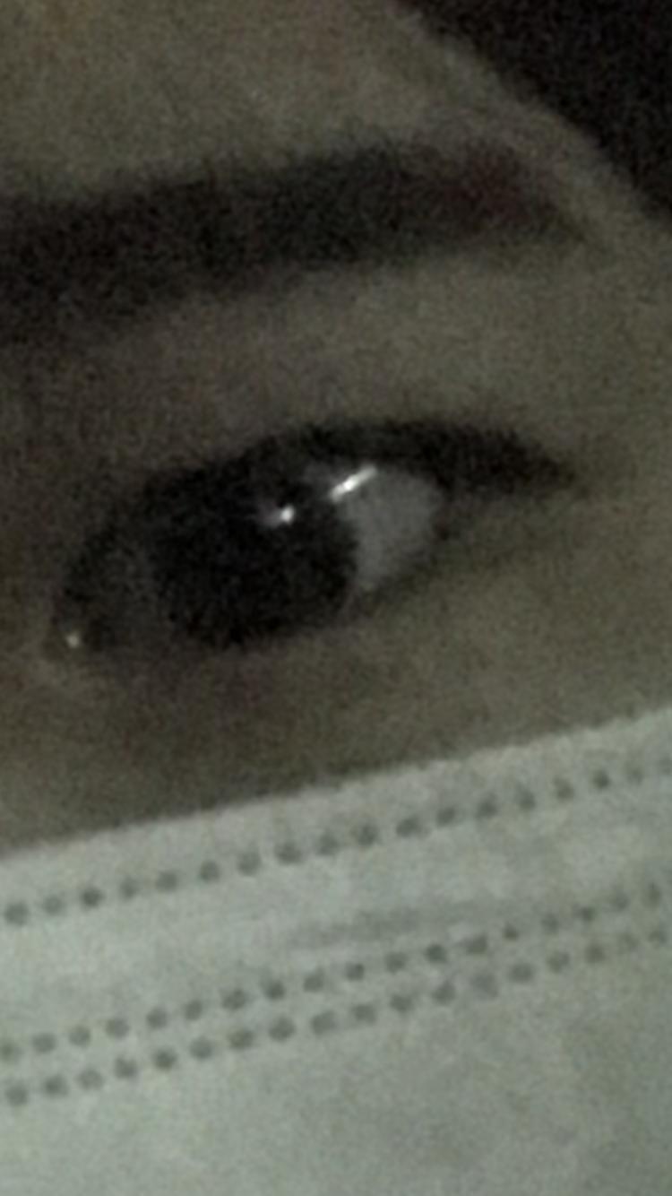 눈은 지방이 완전완전 많고 평소엔 쌍테 붙이고 다님 이 둘은 쌍테 붙였을때 근데 2처럼 묻힐때도 있음