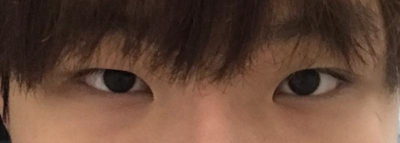 글쓴인데 사진 이렇게 올리는거 맞나 아무튼 내가 짝눈이 그렇게 심해?