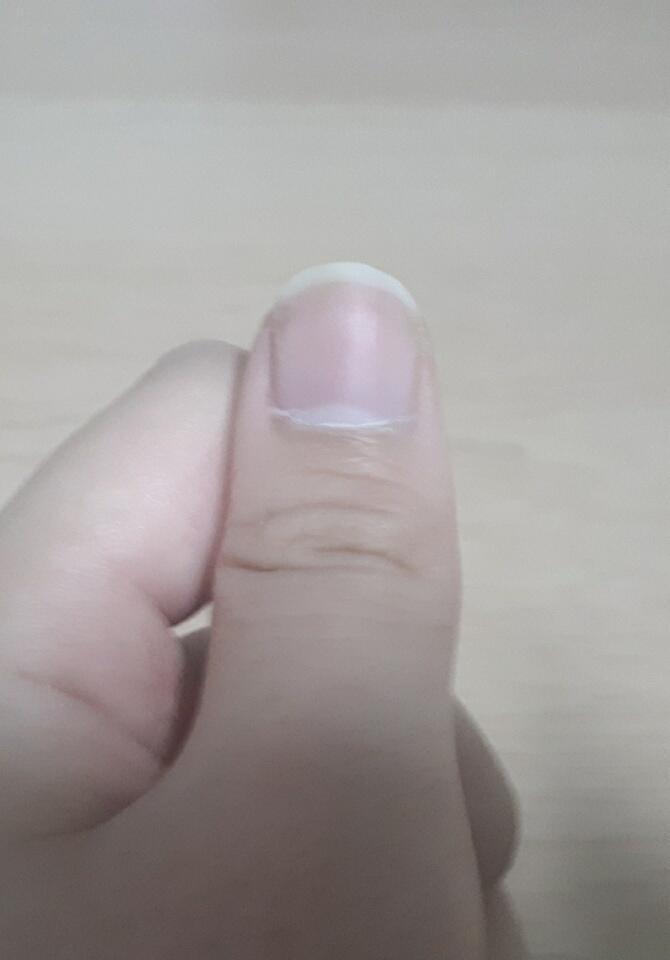 참고로 내 손톱 ㅋㅋㅋ.. 네모네모빔