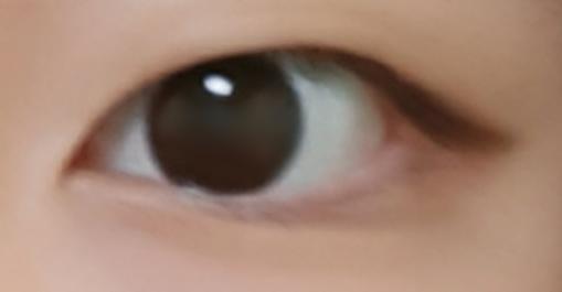 눈
