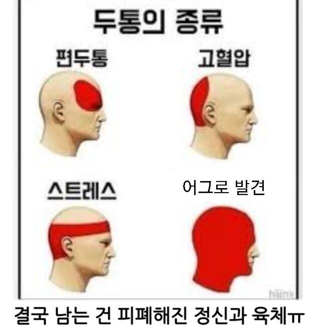 ㄱㅅ