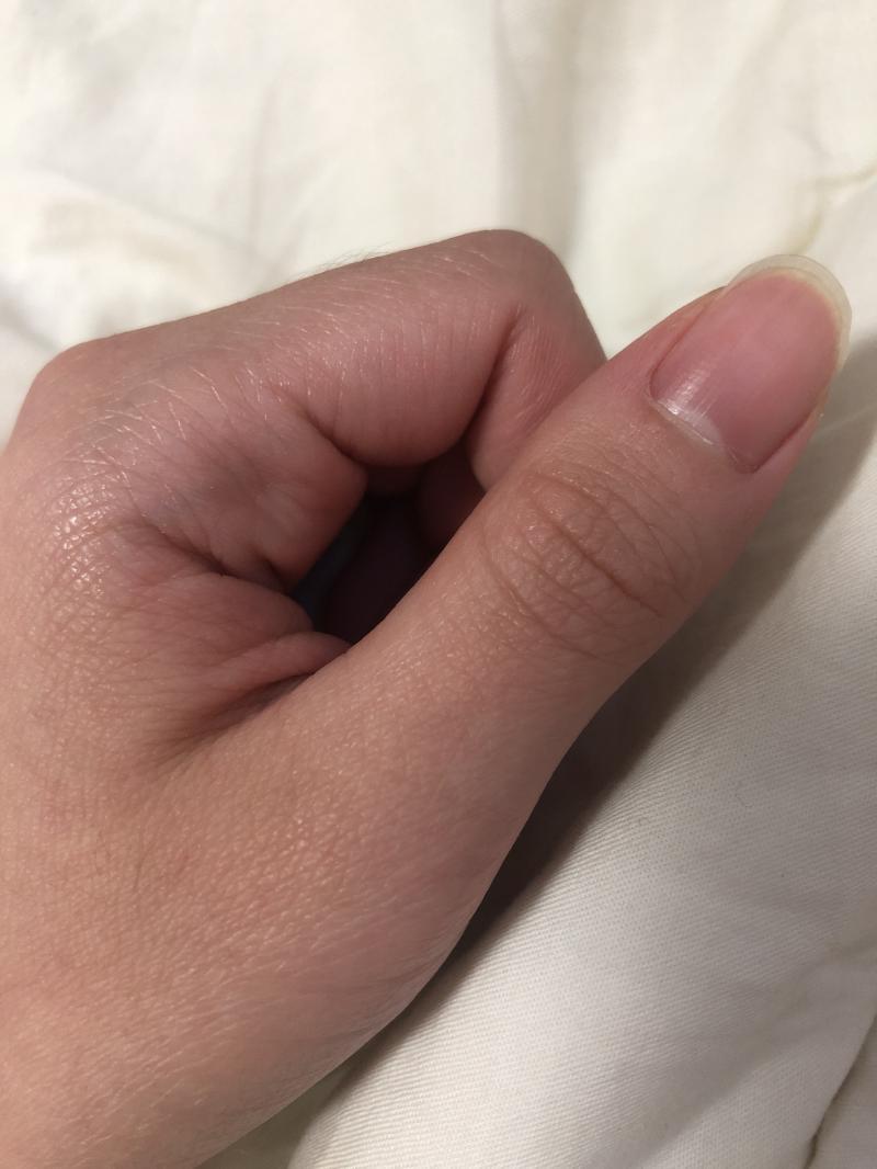 근데 얘들앙 신기한게 엄지빼고는 모든손가락 마디에 털 길고많은데 대체 왜 엄지손가락엔 털이 없는거지...? 너네도 그러지?! 엄지는 깨끗해 그치