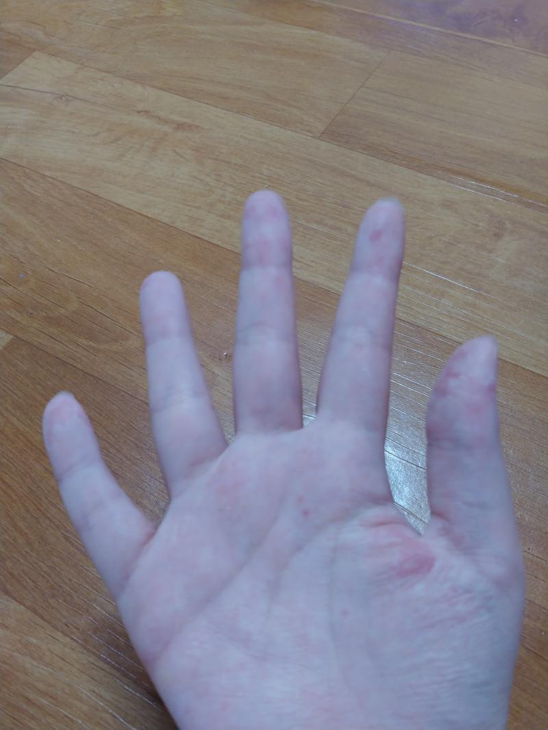 내 양 손은 다 이 꼬라지고....