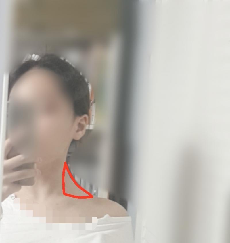 여기가 내가 만져봐도 딱딱하고 막 그래 다른 애들은 이렇게까지 안 그러던데ㅠㅠ